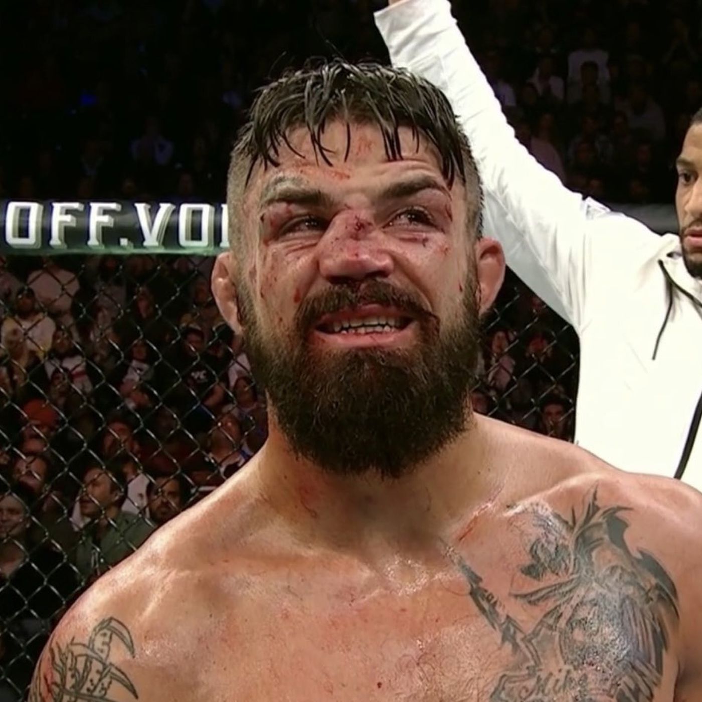 Mike Perry Nose Surgery Details What Did He Do